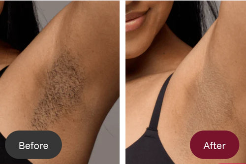 No irritation, no razor bumps